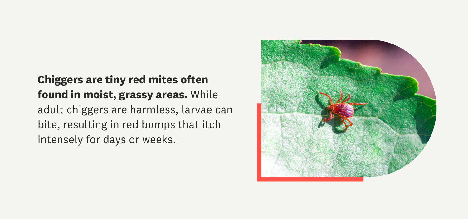 Ouch! How to Get Rid of Chiggers in Your Yard and Home | Angi